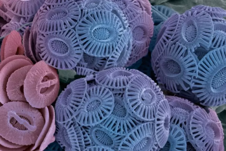 A closeup of phytoplankton